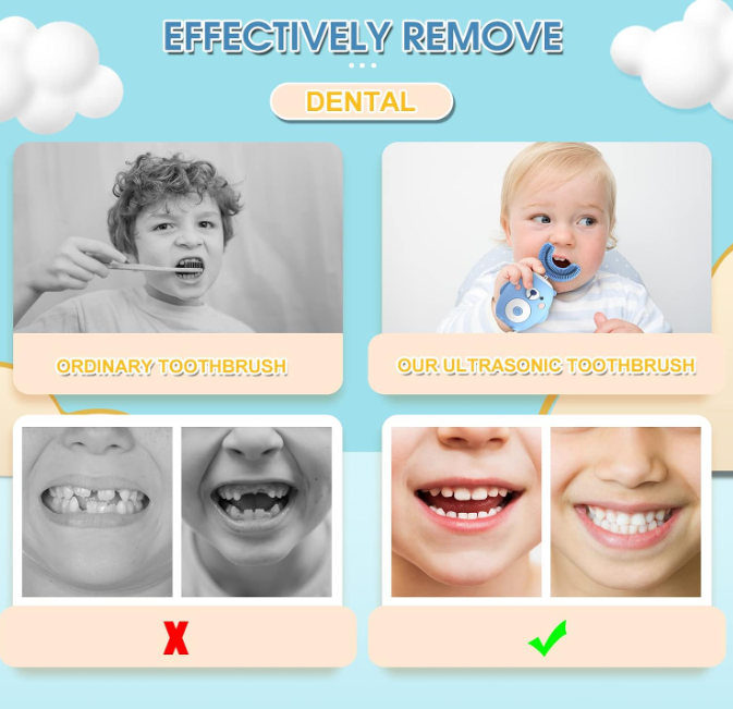 Kids U-Shaped Silicone Electric Toothbrush – 360° Automatic Toothbrush