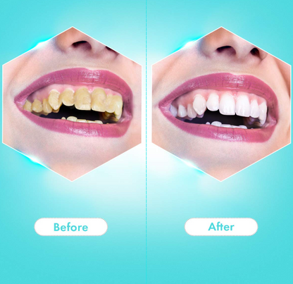 2-in-1 Electric Toothbrush & Dental Scaler – Sonic Teeth Cleaning Tool
