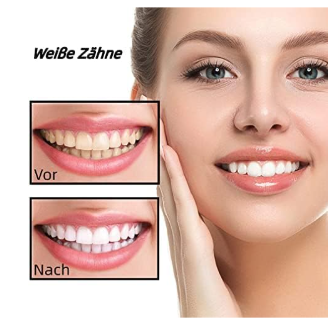 5D Teeth Whitening Strips – Gel Whitening Strips for a Brighter Smile