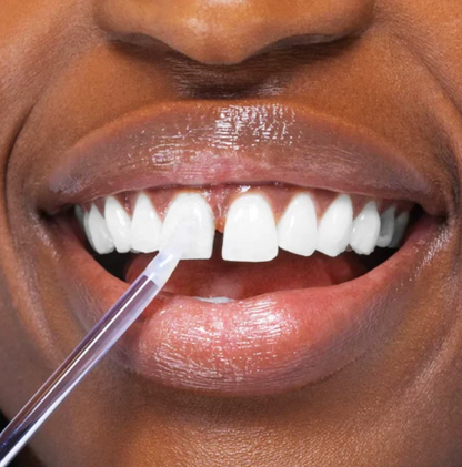 Tooth Gloss Whitening Pen – Instant Smile Brightening